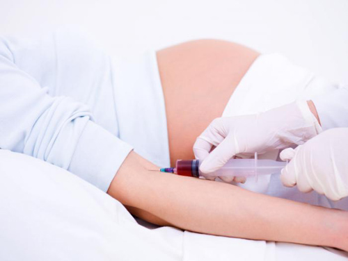 Xét nghiệm adn thai là gì